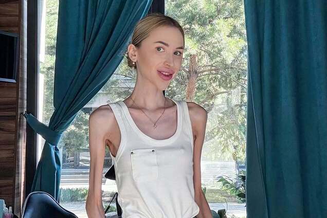 Важить 23 кг і мріє схуднути ще більше: що відомо про блогерку Аліну Ліпницьку, яку звинувачують в анорексії. Фото