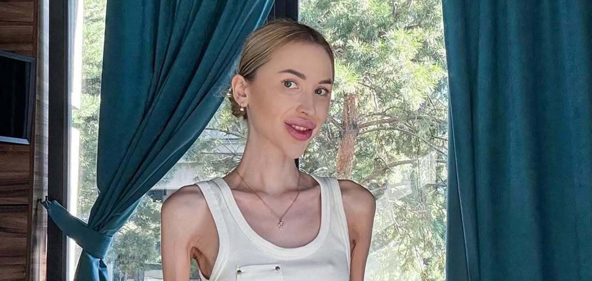 Весит 23 кг и мечтает похудеть еще больше: что известно о блогере Алине Липницкой, которую обвиняют в анорексии. Фото