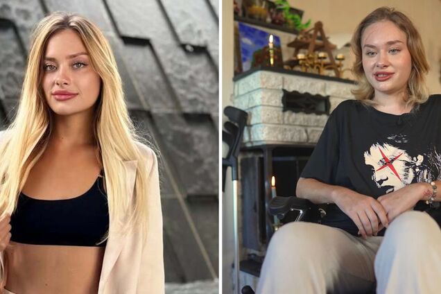 'Узнали?' Покалеченная в Дубае Мария Ковальчук вернулась в соцсети и показала, как живет через 7 месяцев после трагедии