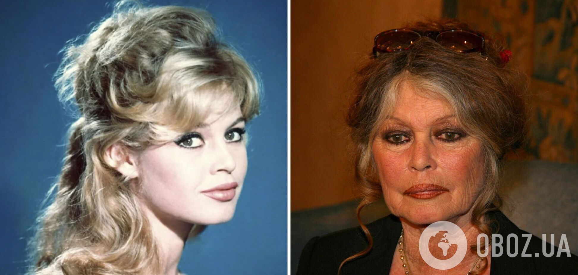 Тяжкохвора Бріжіт Бардо перенесла операцію на 92 році життя: зʼявилися тривожні новини про стан секс-символа ХХ століття