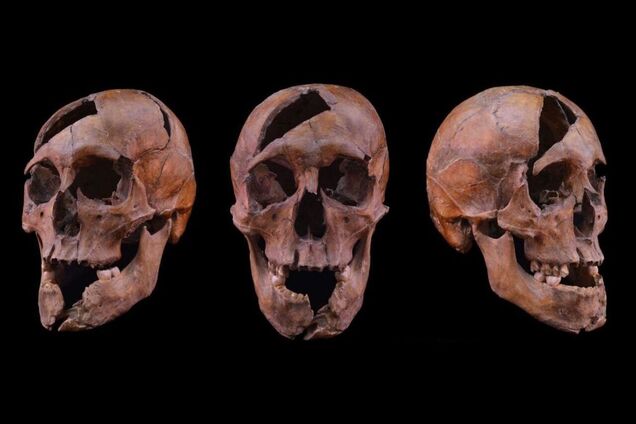 Нанесли 26 ударов: убитый в XIII веке мужчина оказался сыном галицкого князя. Фото