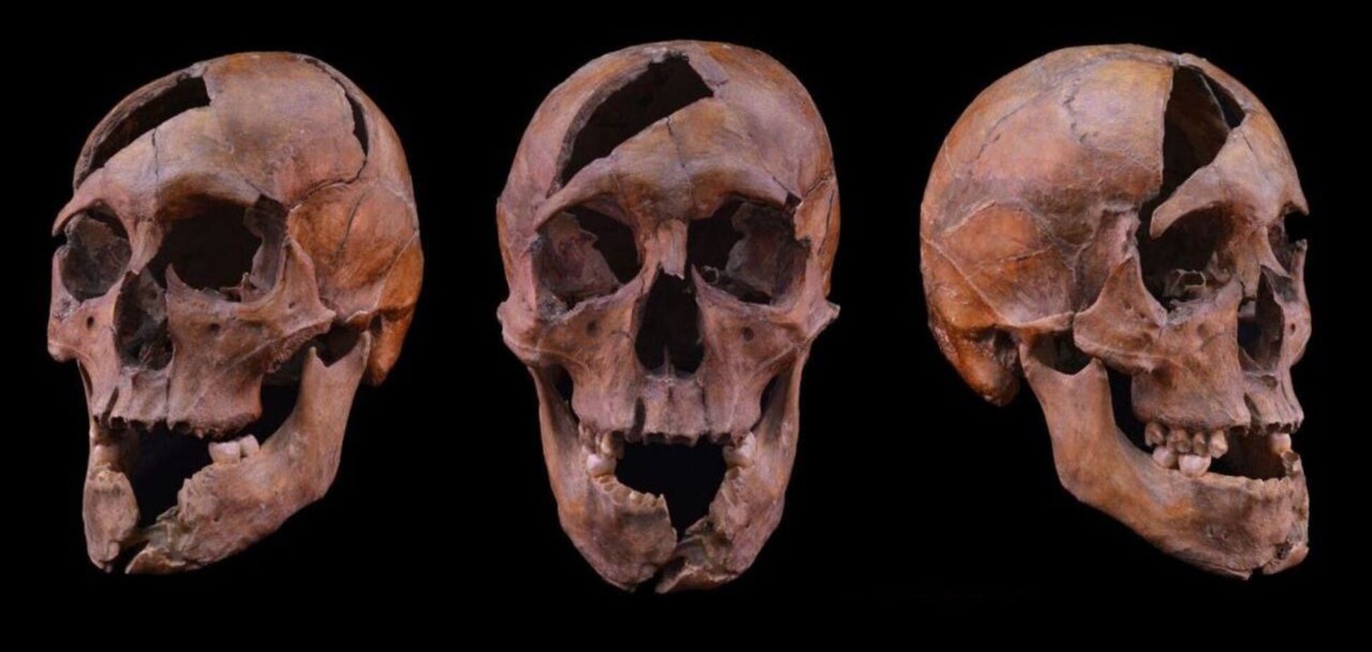 Нанесли 26 ударов: убитый в XIII веке мужчина оказался сыном галицкого князя. Фото