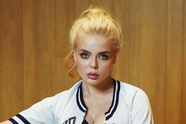 Алине Гросу вызвали скорую на съемках из-за 'беды' с лицом: артистка назвала диагноз и не сдержала слез