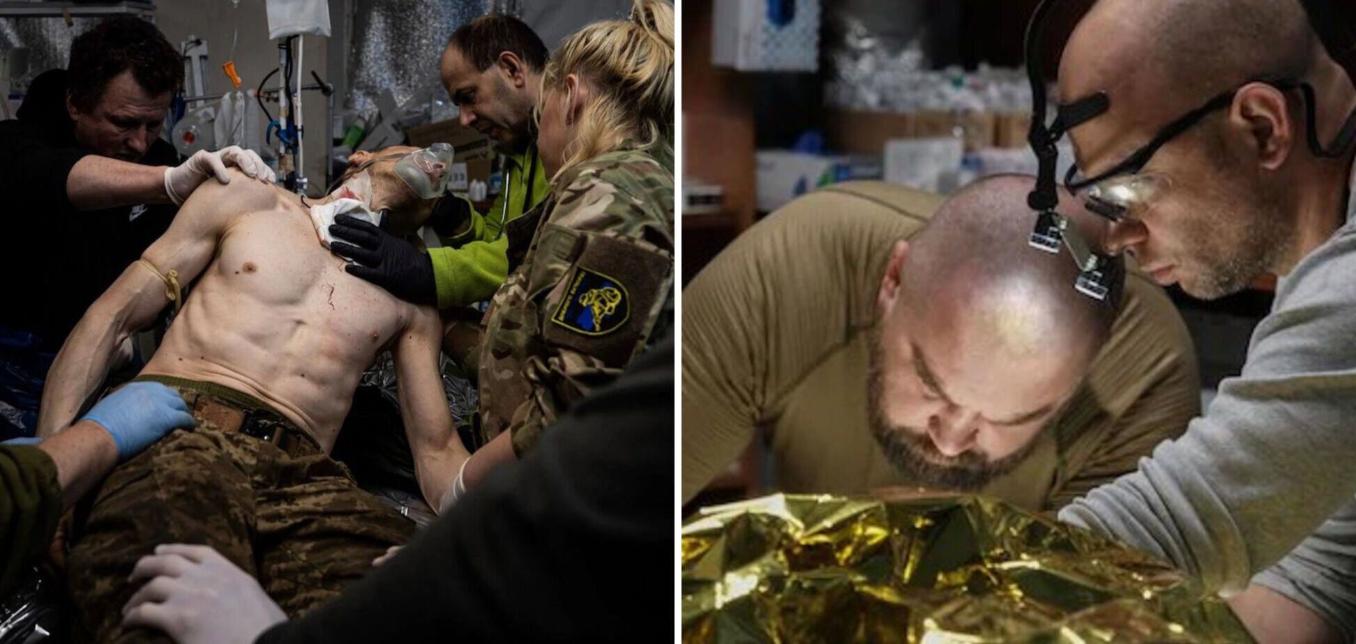 В Україну повернулась хвороба часів Першої світової війни: чим вона небезпечна