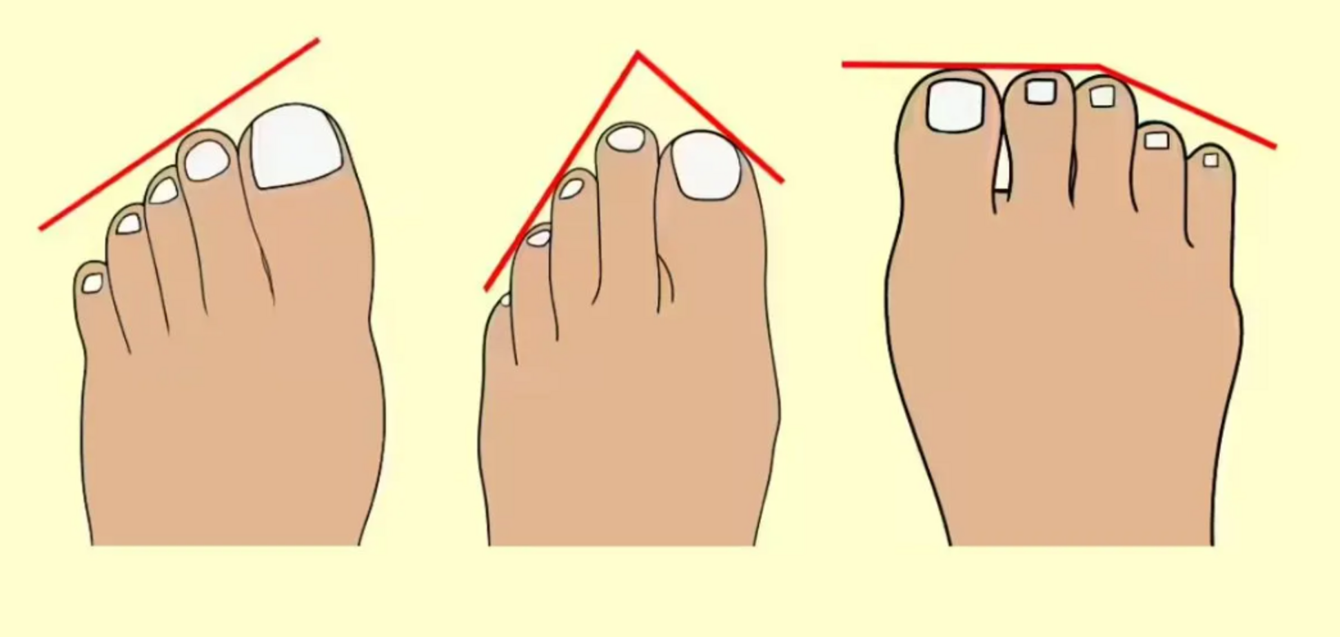 У вас египетская, греческая или римская стопа? Тест на личность