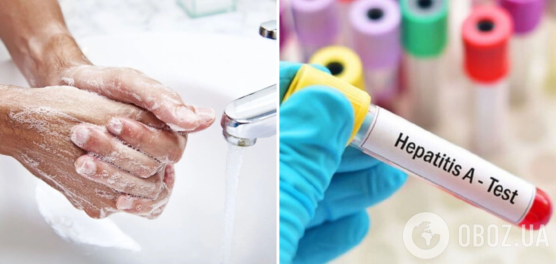 На Закарпатті зафіксували спалах гепатиту А: в одному із сіл запровадили жорсткі обмеження для туристів