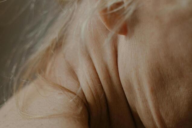 Как избавиться от морщин на шее: советы, которые сделают вас моложе