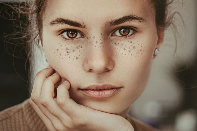 Як зробити ідеальні штучні веснянки: безвідмовний спосіб