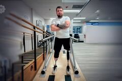 Украинский защитник перенес ампутацию ног, 25 операций и снялся в фильме: история настоящего героя