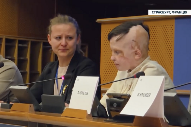 Перекладачка у Європарламенті розплакалася під час виступу 11-річного Романа, який дивом вижив під час російського обстрілу Вінниці. Відео