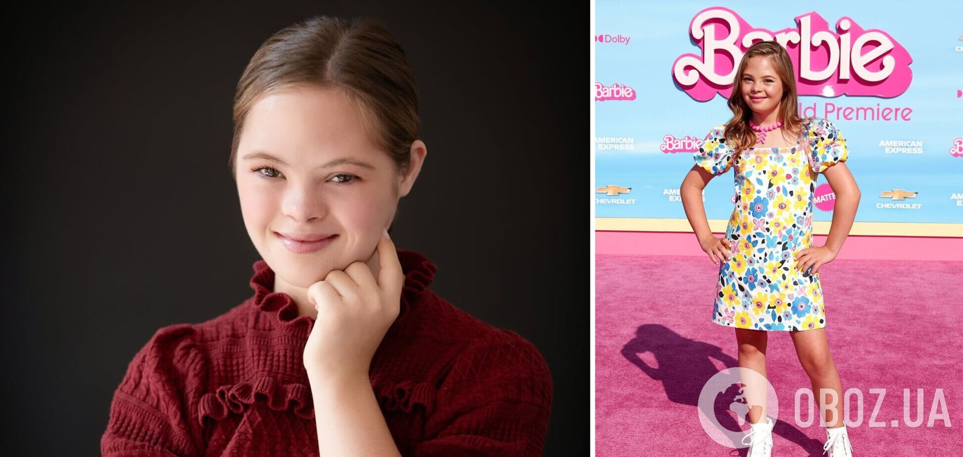 Журналисты нашли биологических родителей украинки с синдромом Дауна Софии Санчес – звезды 'Барби' и 'Голодных игр': финал шокировал