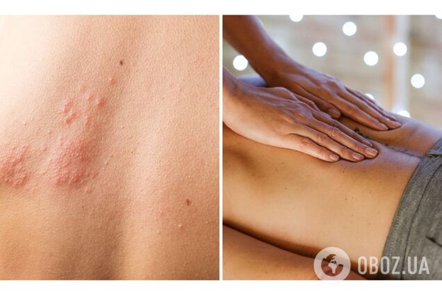 У працівниць спа-центру в Румунії зафіксували випадки небезпечної хвороби: виявлено вперше за 44 роки