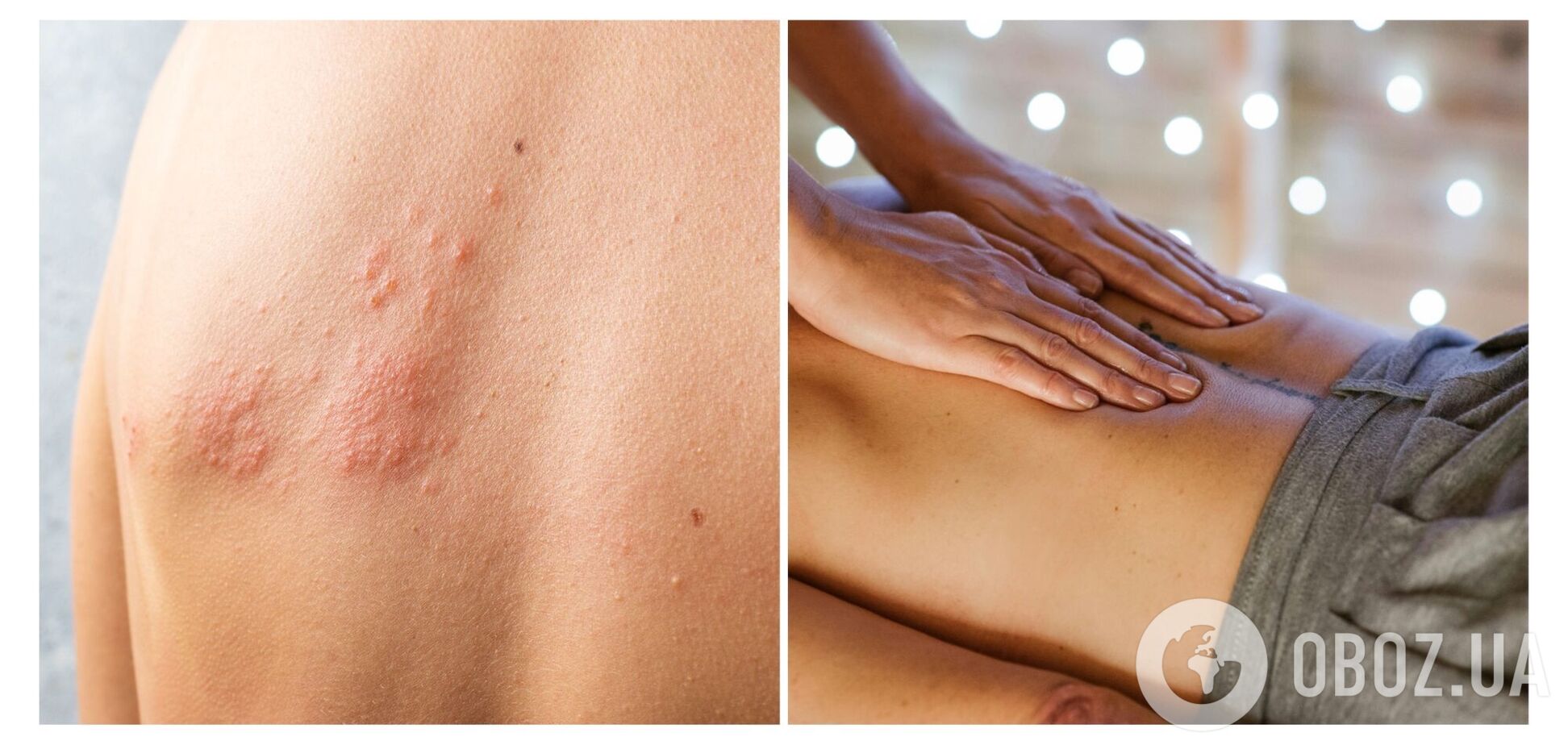 У працівниць спа-центру в Румунії зафіксували випадки небезпечної хвороби: виявлено вперше за 44 роки