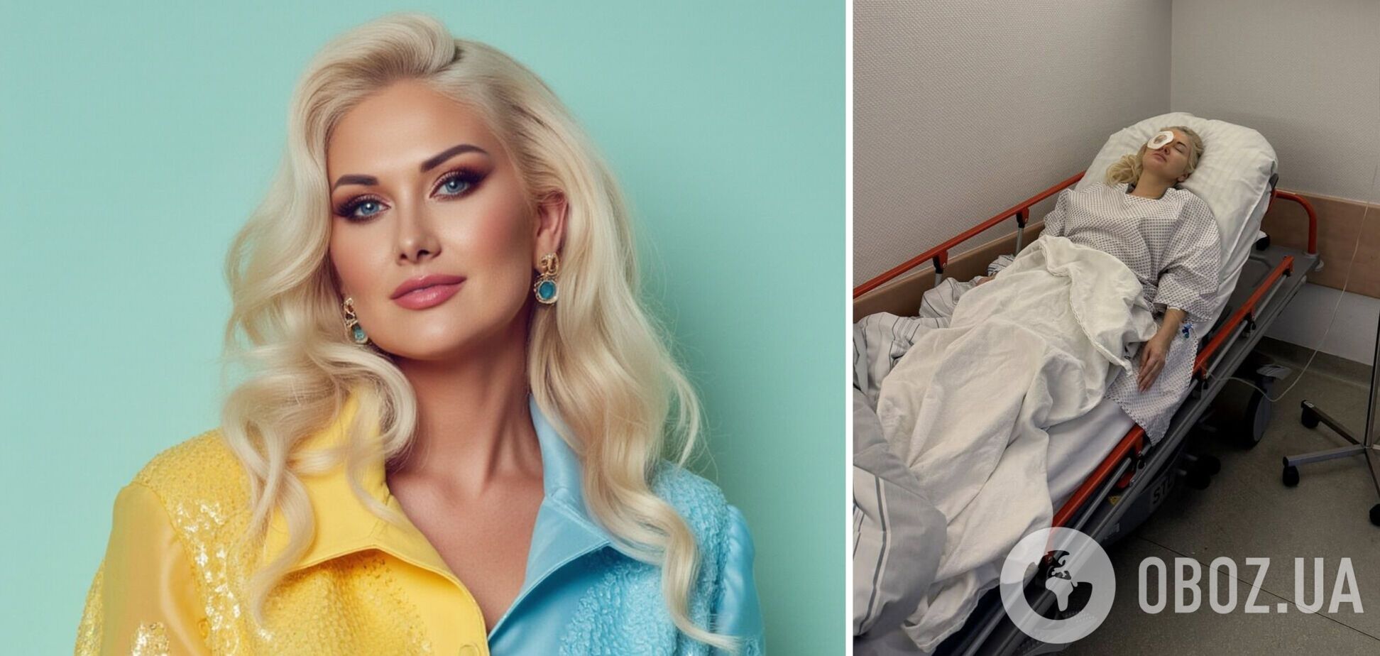 Екатерина Бужинская, которая не выходила на сцену два месяца, перенесла сложную операцию на лице и показала, как выглядит теперь