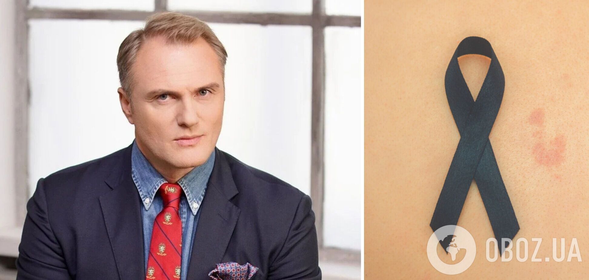 Євген Рибчинський захворів на онкологію та вперше розповів про дві перенесені операції: це спадкове