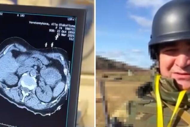 Були метастази в печінці: український прикордонник поборов рак четвертої стадії і повернувся в стрій. Відео