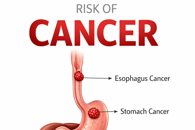 Рак шлунково-кишкового тракту у молодих: чому вік більше не захищає