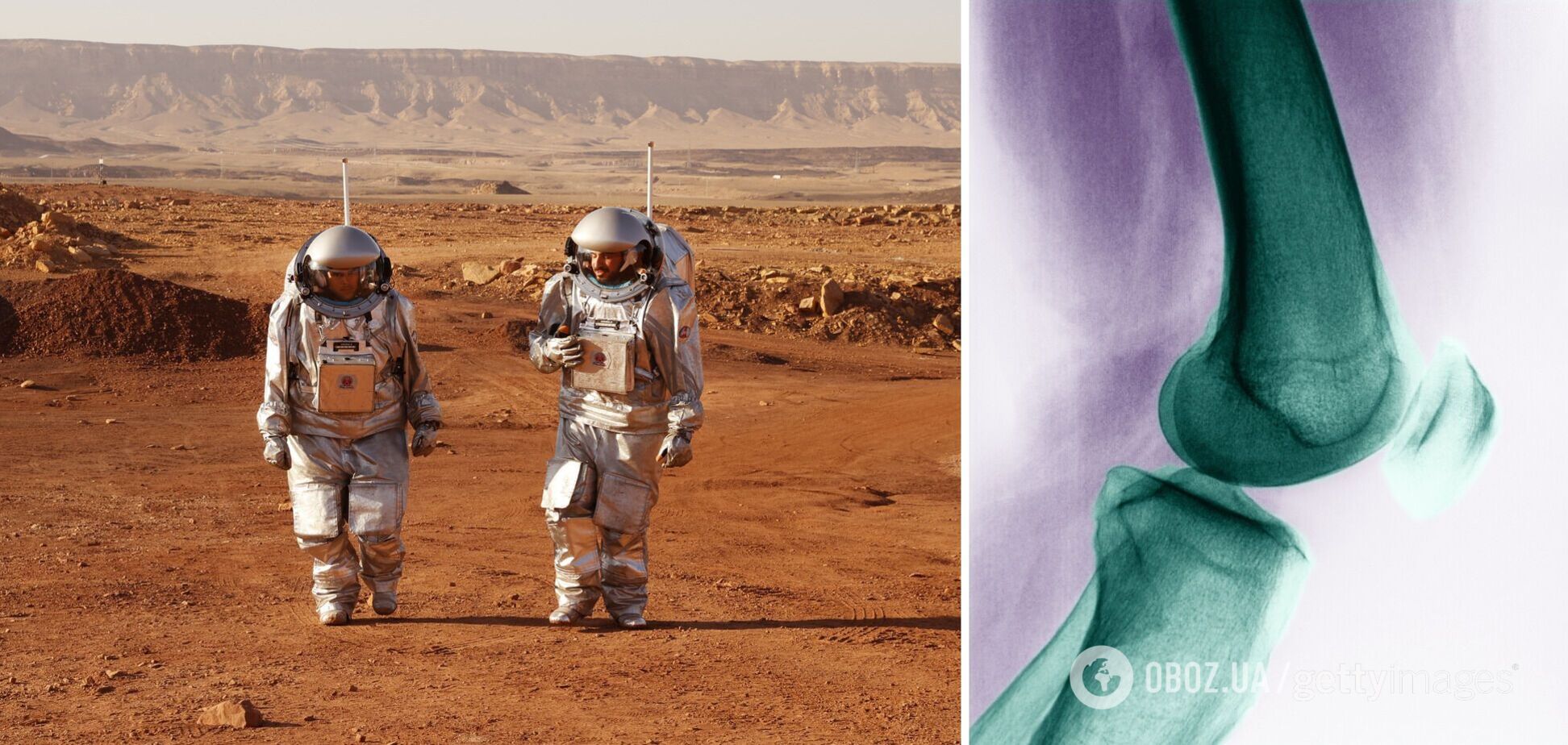 Достаточно 1 минуты! Ученые назвали простое упражнение для астронавтов, которое увеличивает продолжительность жизни и защищает колени