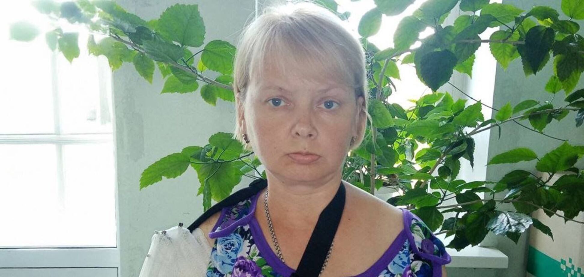 'Це шанс відновити руку': Фонд Ріната Ахметова допоміг у лікуванні важкопораненої мешканки Мирнограда