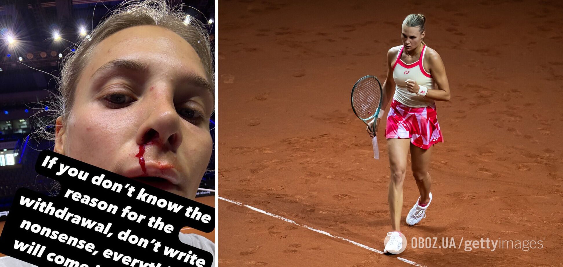 Знаменитая украинская теннисистка отказалась выступать и ушла посредине матча на турнире в Штутгарте. Видео