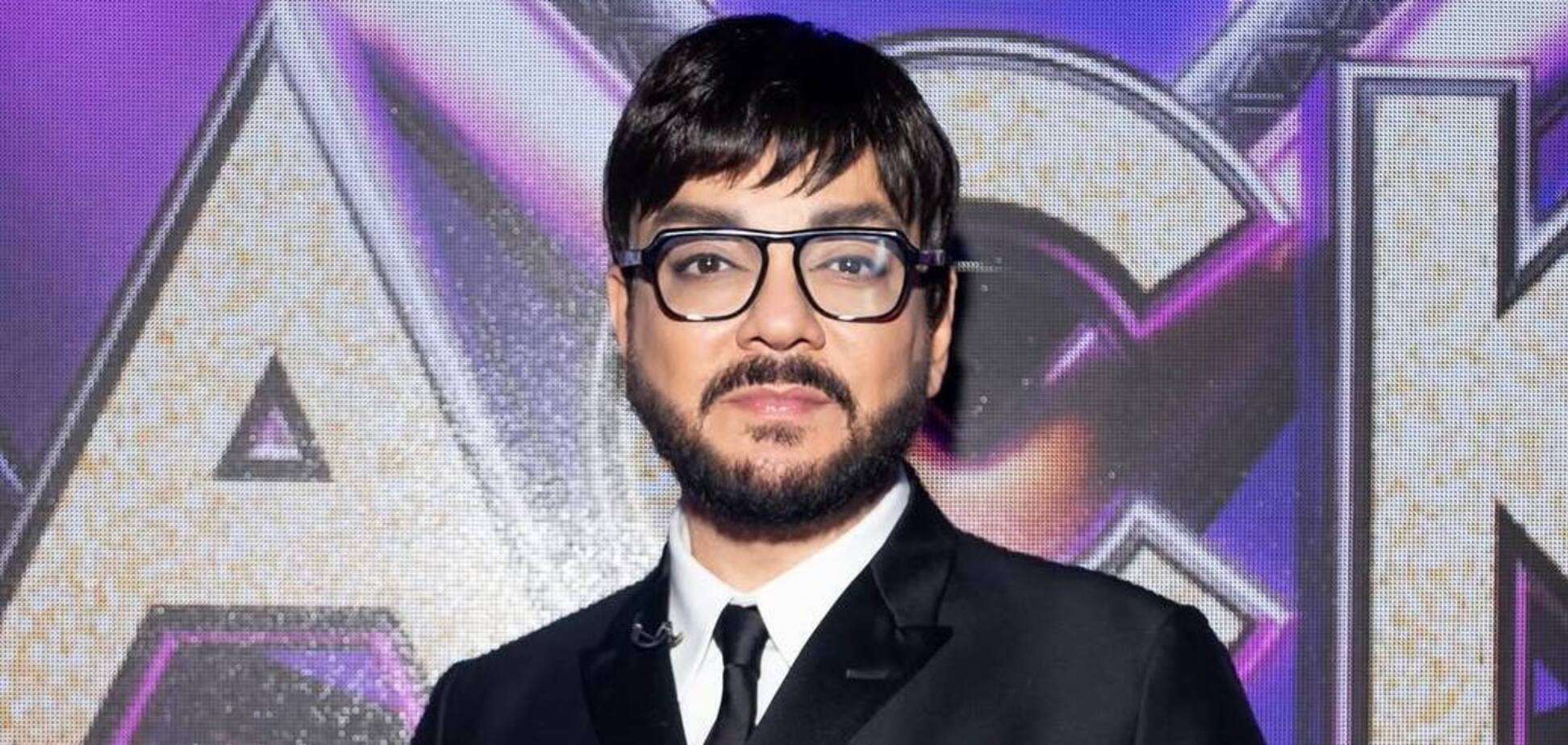 Путіністу Кіркорову, який обгорів на концерті, стало гірше: росіян закликали молитися