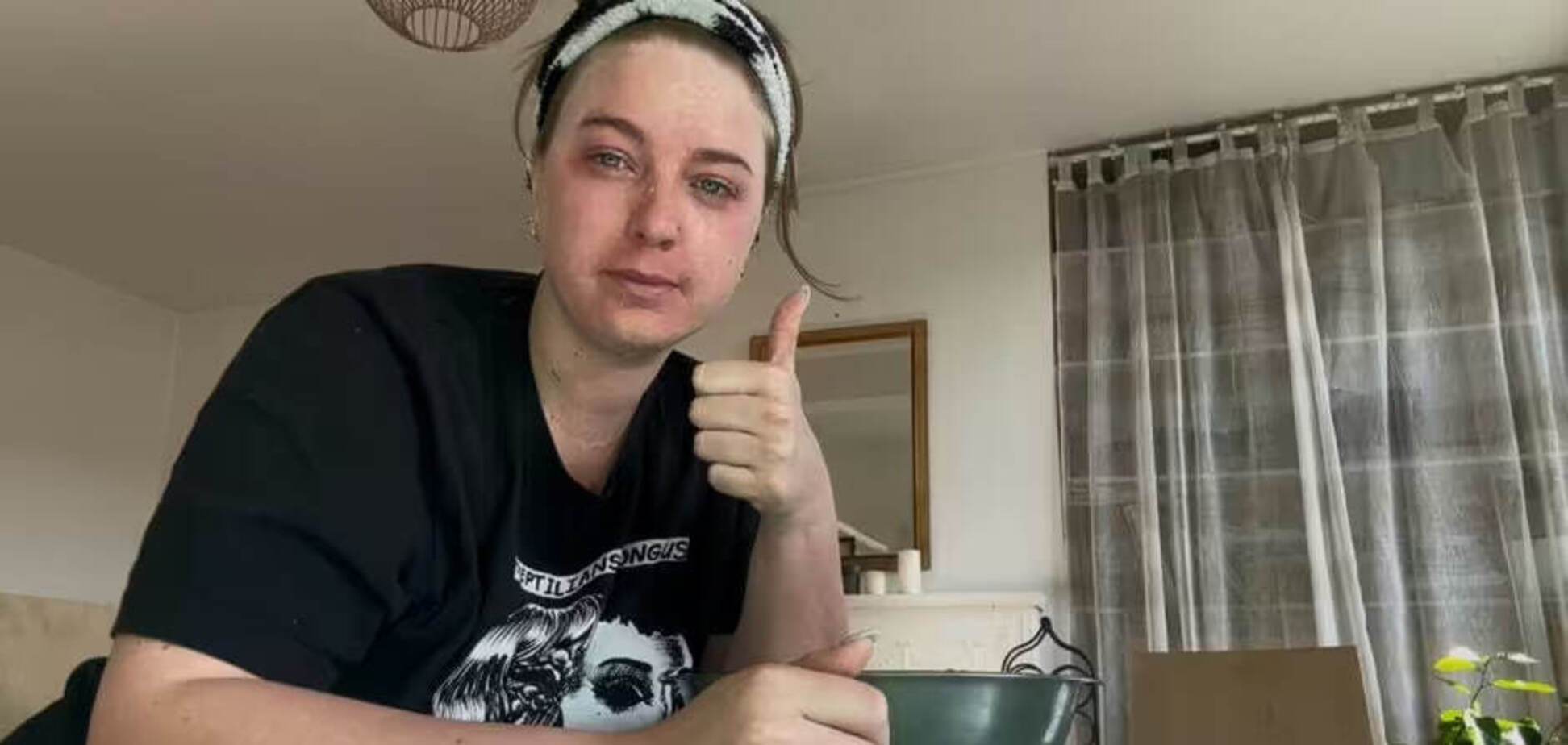 Б’юті-експеримент: що змінилося після тижня крижаних ванн для обличчя