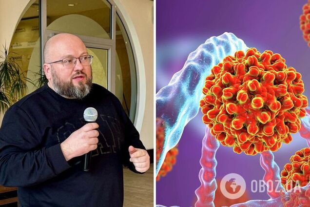 У Києві вже зареєстрували 76 випадків гепатиту А: названо ймовірну причину спалаху