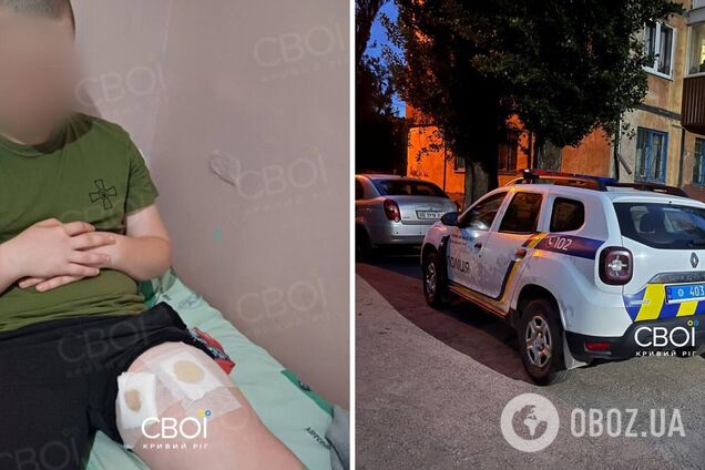 'Услышали только свист': в Кривом Роге выстрелили в ногу ребенку на площадке. Фото