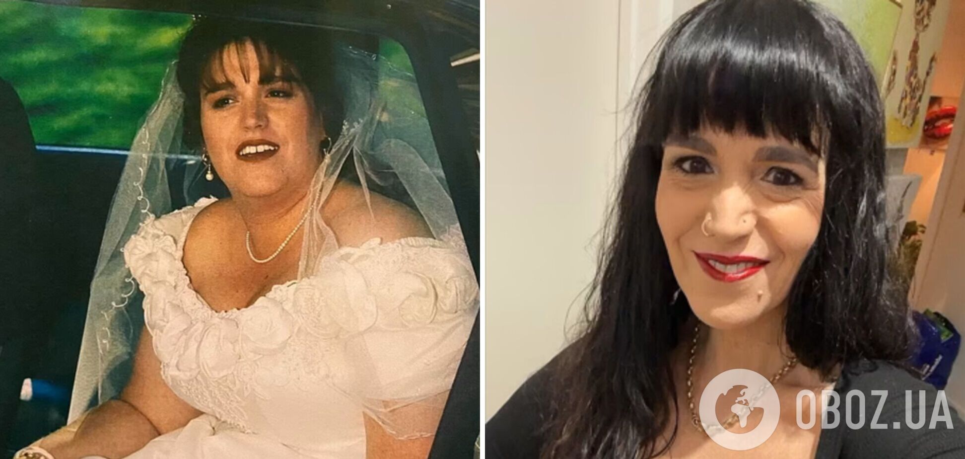 'Это ад': женщина, которая похудела на 15 кг с помощью популярного препарата, поразила, что с ней произошло дальше. Фото