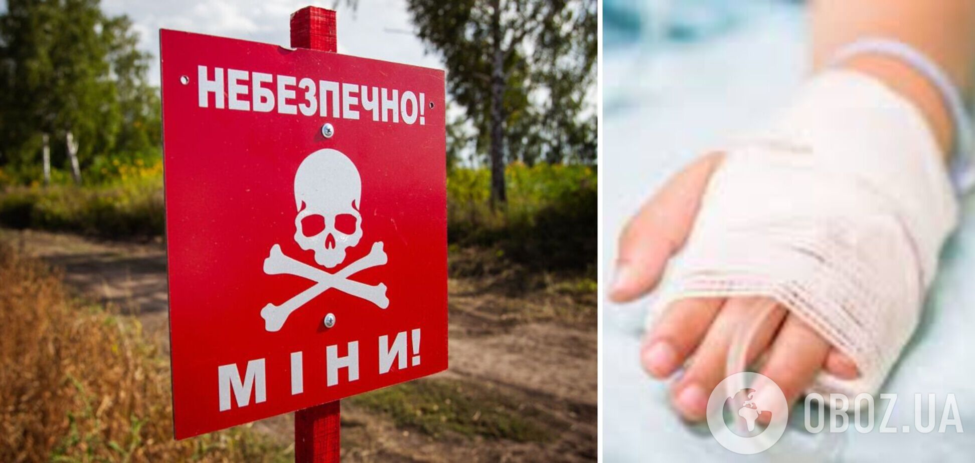 Знайшов у полі невідомий предмет, який вибухнув: на Харківщині постраждав 11-річний хлопчик