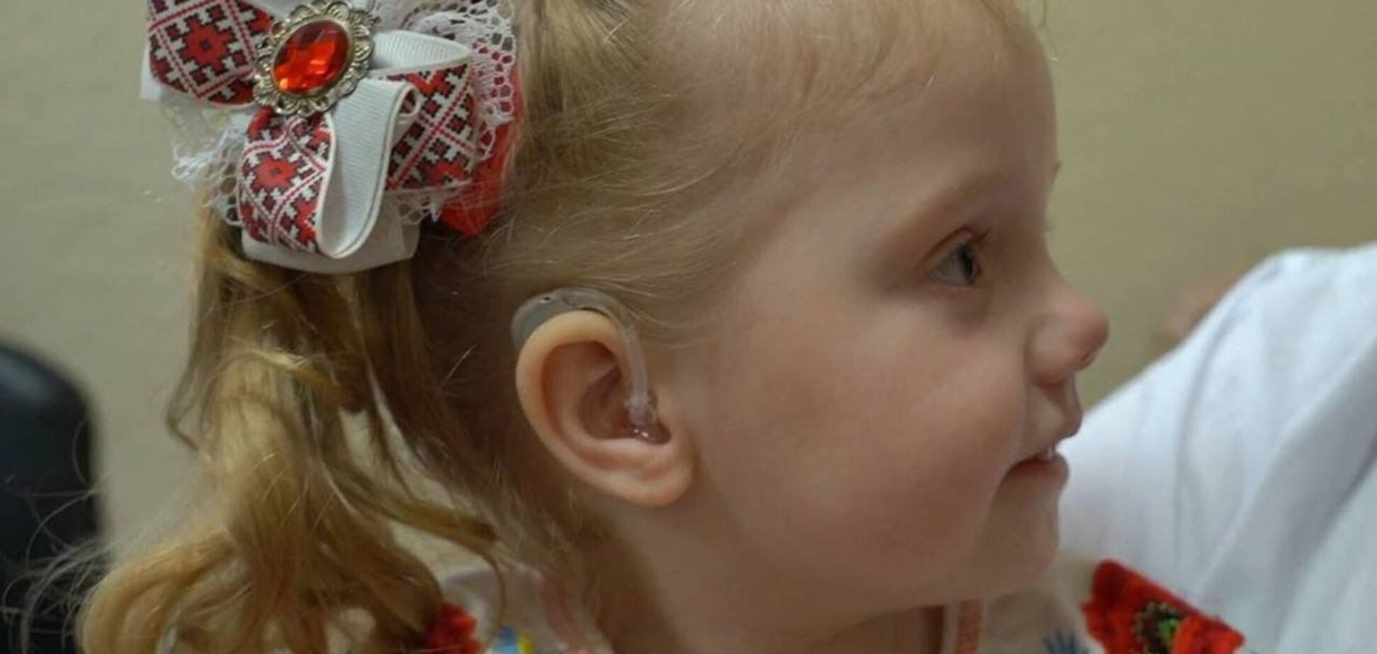 'Дитина почне розмовляти': 3-річна Катруся з Дніпра отримала слухові апарати, забезпечені Фондом Ріната Ахметова