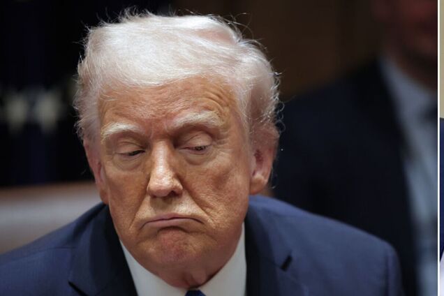 У Трампа виявили вікові проблеми з венами: що ще показав медогляд