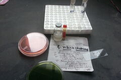 В Польше обнаружили первый за шесть лет случай холеры: 20 человек посадили на карантин