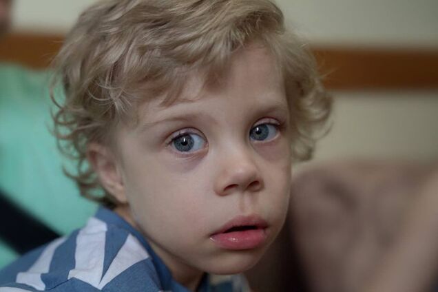 3-летний Михаил из Днепра получил слуховые аппараты от Фонда Рината Ахметова
