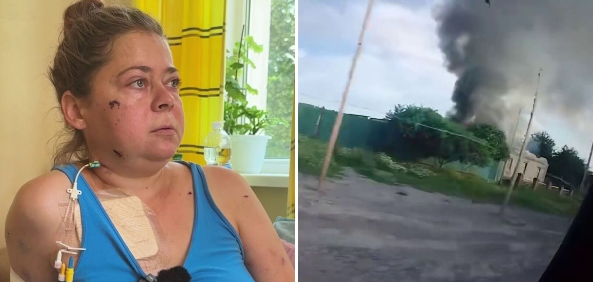 'Ми тільки сіли на зупинці – й одразу приліт': пасажирка автобуса на Сумщині, по якому вдарили окупанти, розповіла про атаку. Відео