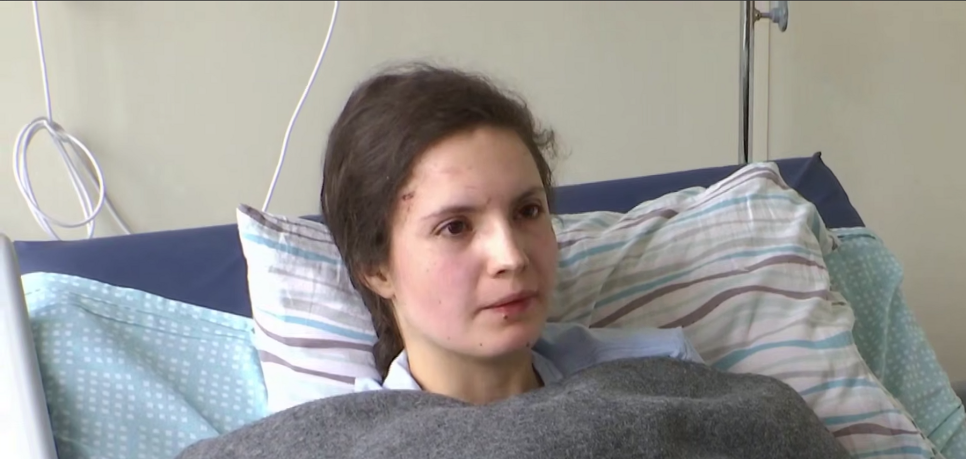 В Киеве девушка выпала с девятого этажа дома во время обстрела РФ и выжила. Видео