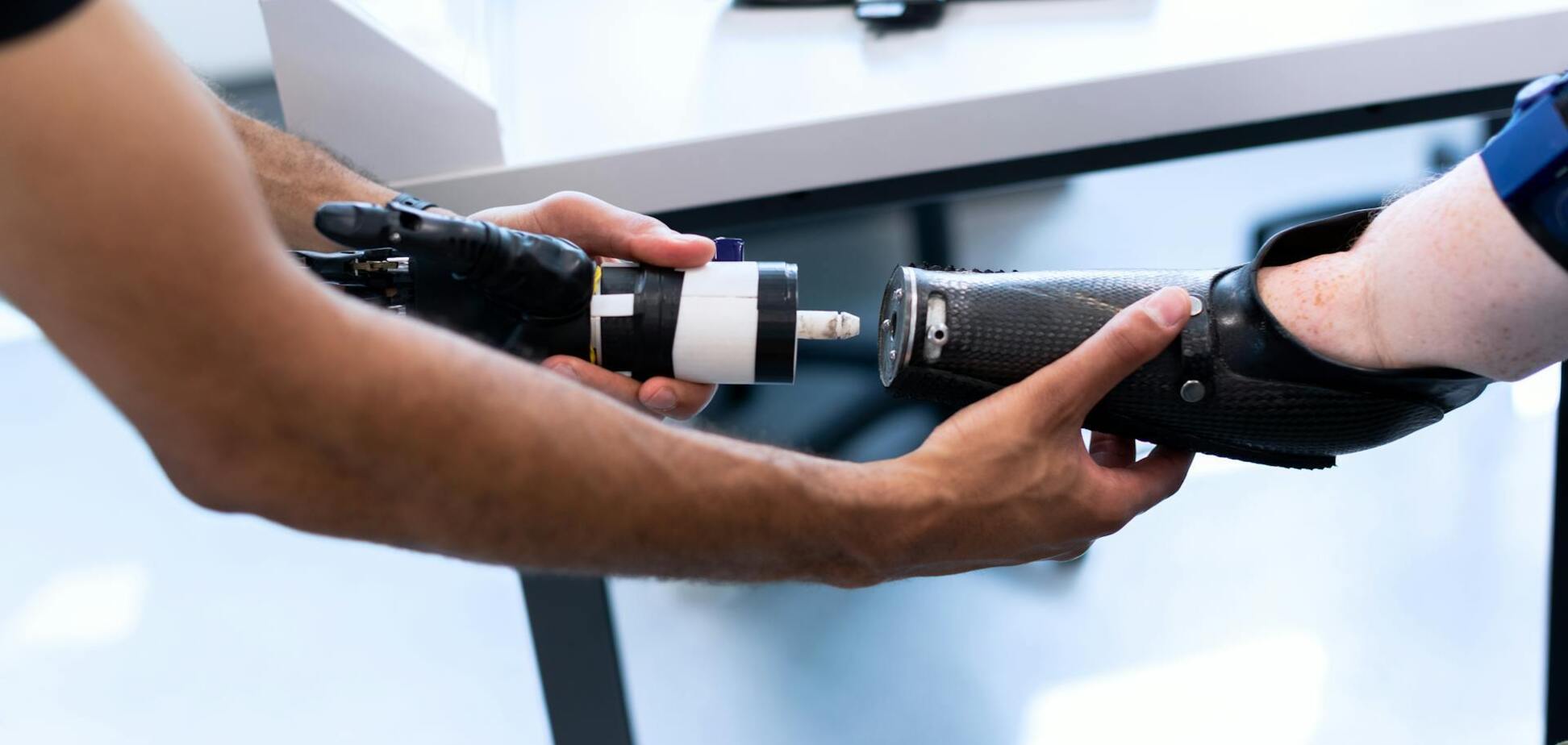 Что происходит в мозге, когда человек теряет конечность: ученые описали феномен