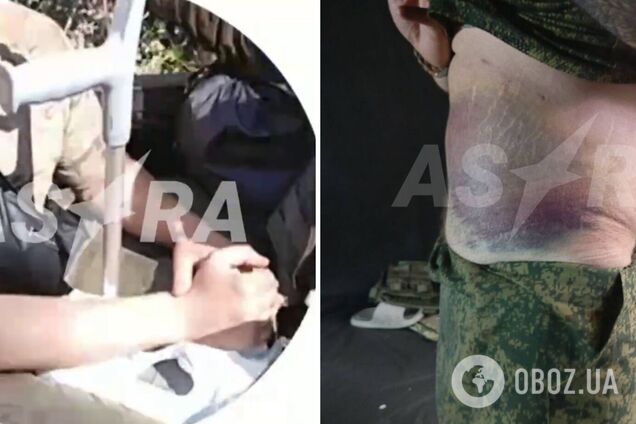 'Повезли обнуляти': Росія відправила своїх солдатів на милицях, у гіпсі та з пластиною в голові у штурм на Сіверському напрямку. Відео