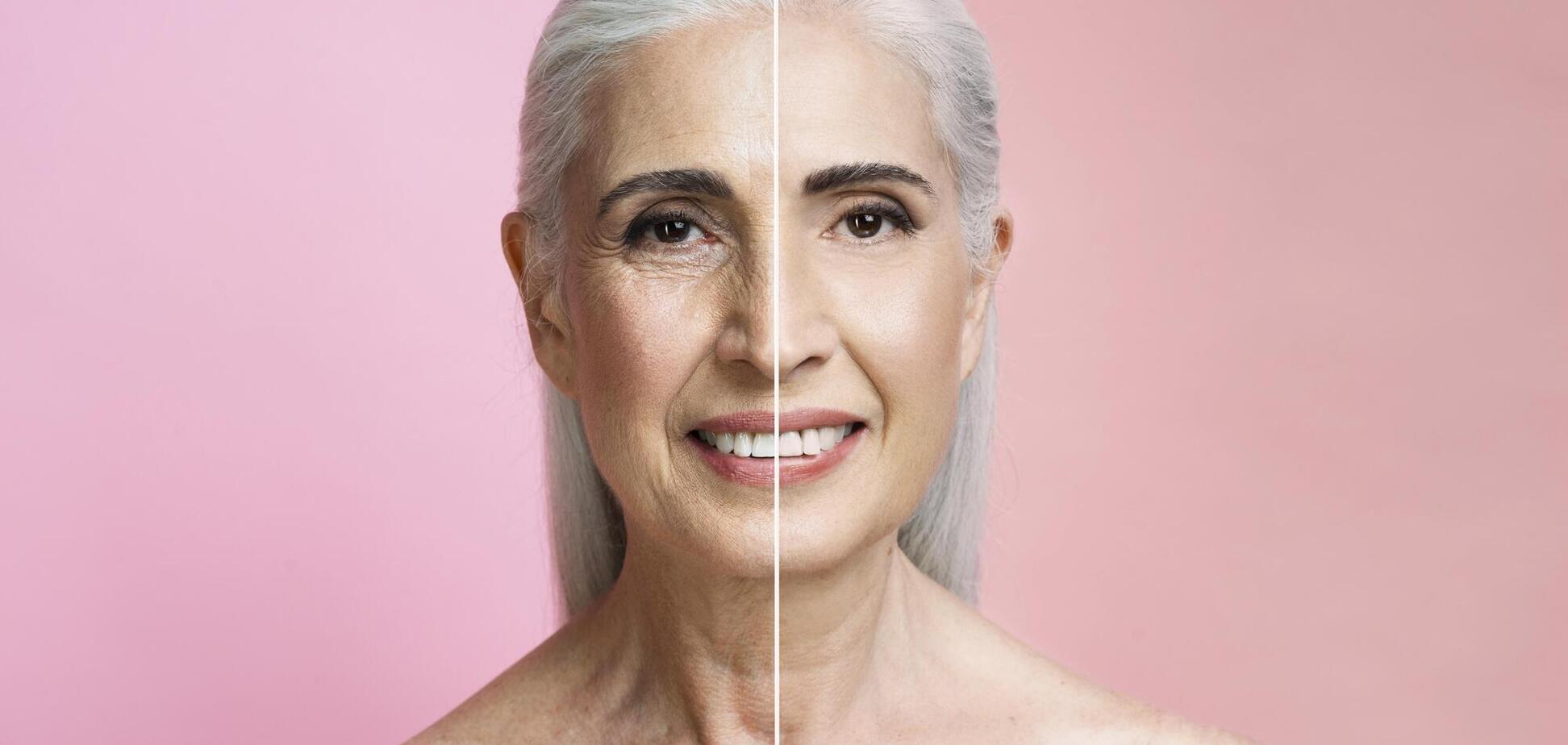 Чому на шкірі зʼявляються зморшки: вчені пояснили механізм