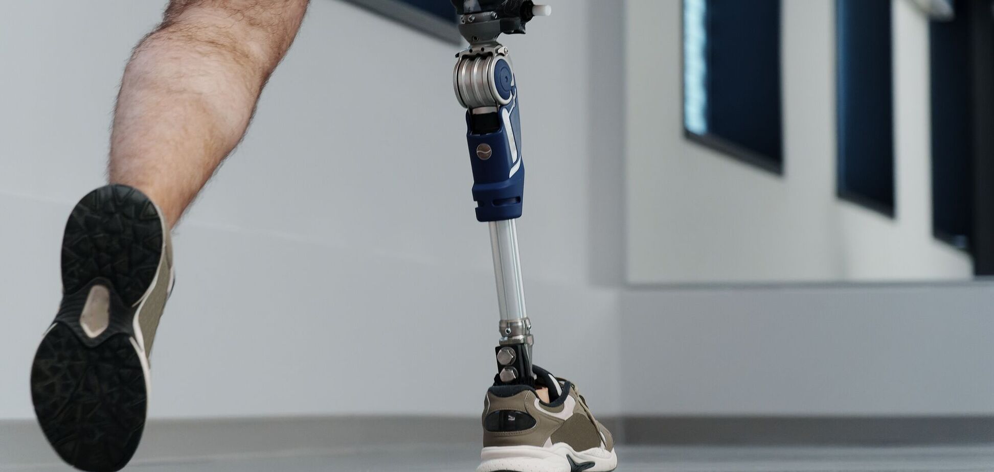 В Україні запрацювала пілотна версія онлайн-хабу 'Є-протез'