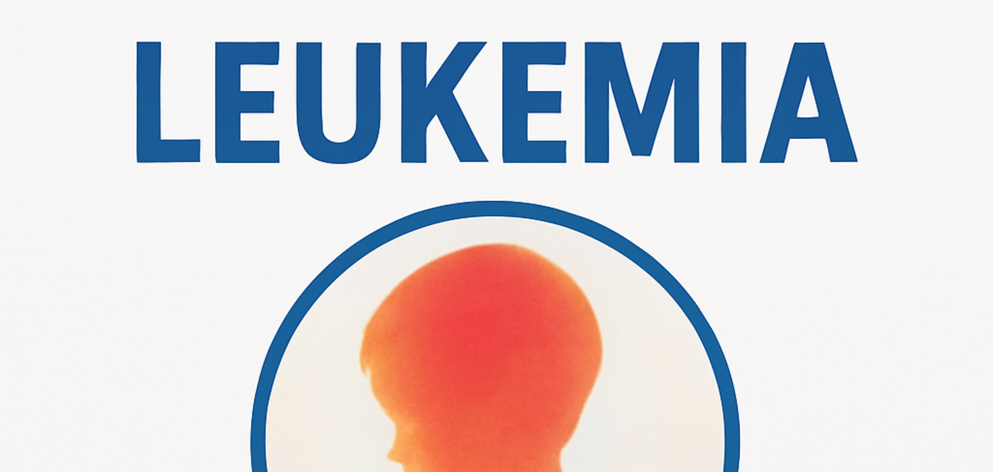 Генетика і дитячий рак: нові дані про ризик розвитку лейкозу