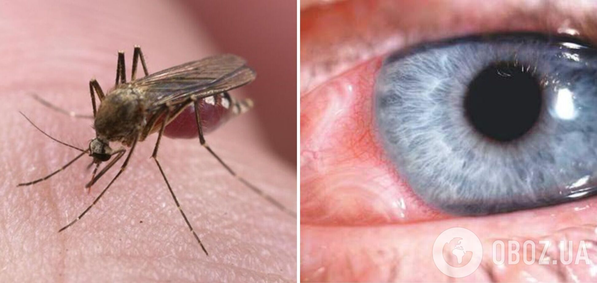 Во Львове врачи удалили из глаза мужчины 12-сантиметрового гельминта: заразился из-за укуса комара на отдыхе. Фото