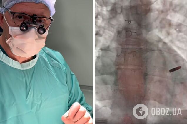 Защитник 'Азовстали' провел три года в плену РФ с пулей в сердце: после освобождения ему сделали операцию. Видео