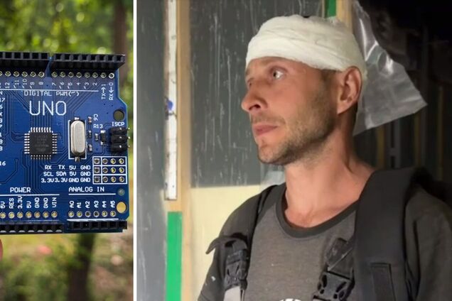 Житель оккупированного Донецка заявил, что из его головы достали чип от дрона: сеть взорвалась комментариями. Видео