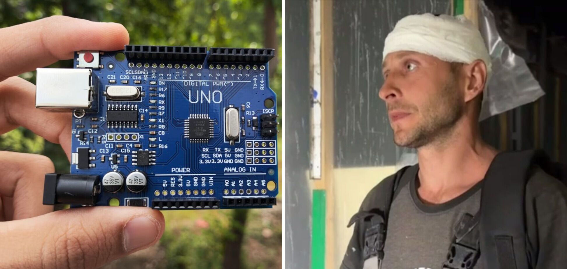 Житель оккупированного Донецка заявил, что из его головы достали чип от дрона: сеть взорвалась комментариями. Видео