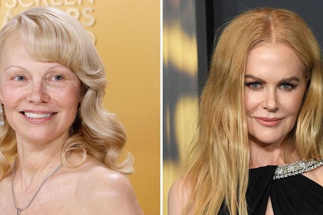 Зірки, які збільшили груди і пошкодували про це: фото до та після мамопластики