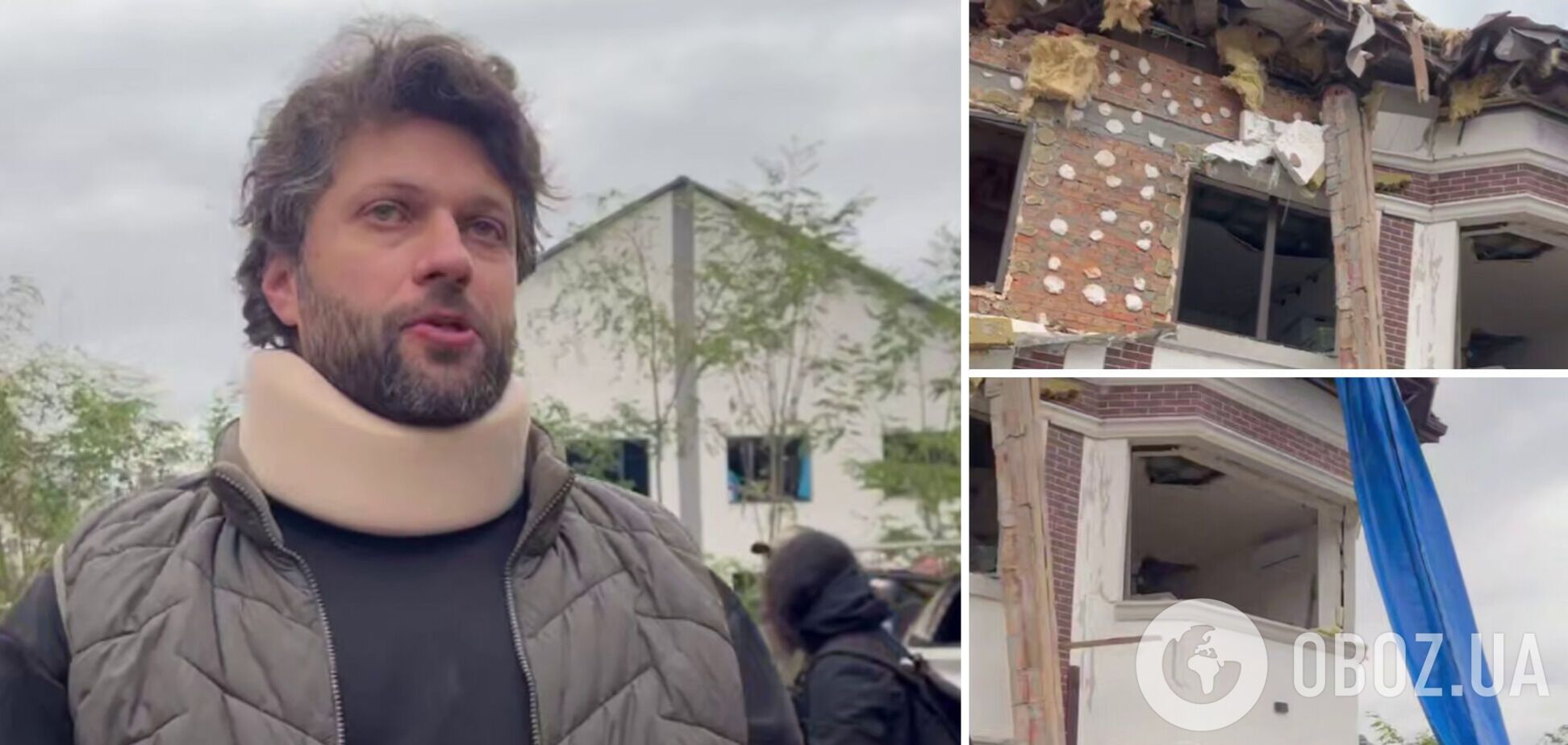 'Детей достань!' Пострадавшие от ударов армии РФ в Киеве рассказали о пережитом