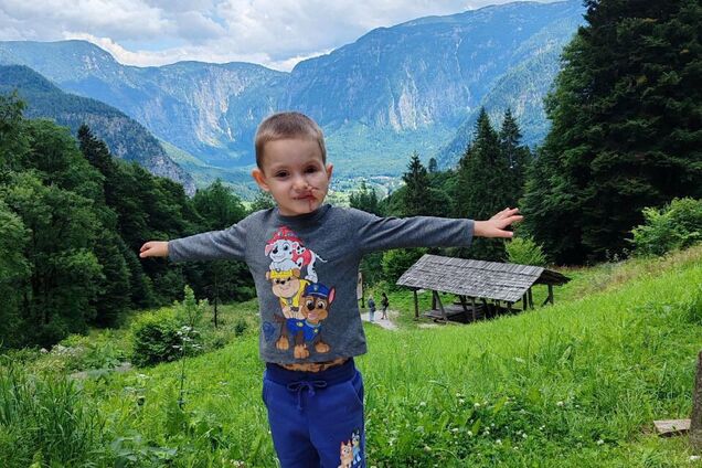 Було накладено 500 швів, дитина росте в лікарнях: як склалась доля хлопчика, який постраждав від вибуху на виставці в Чернігові у 2022 році. Фото