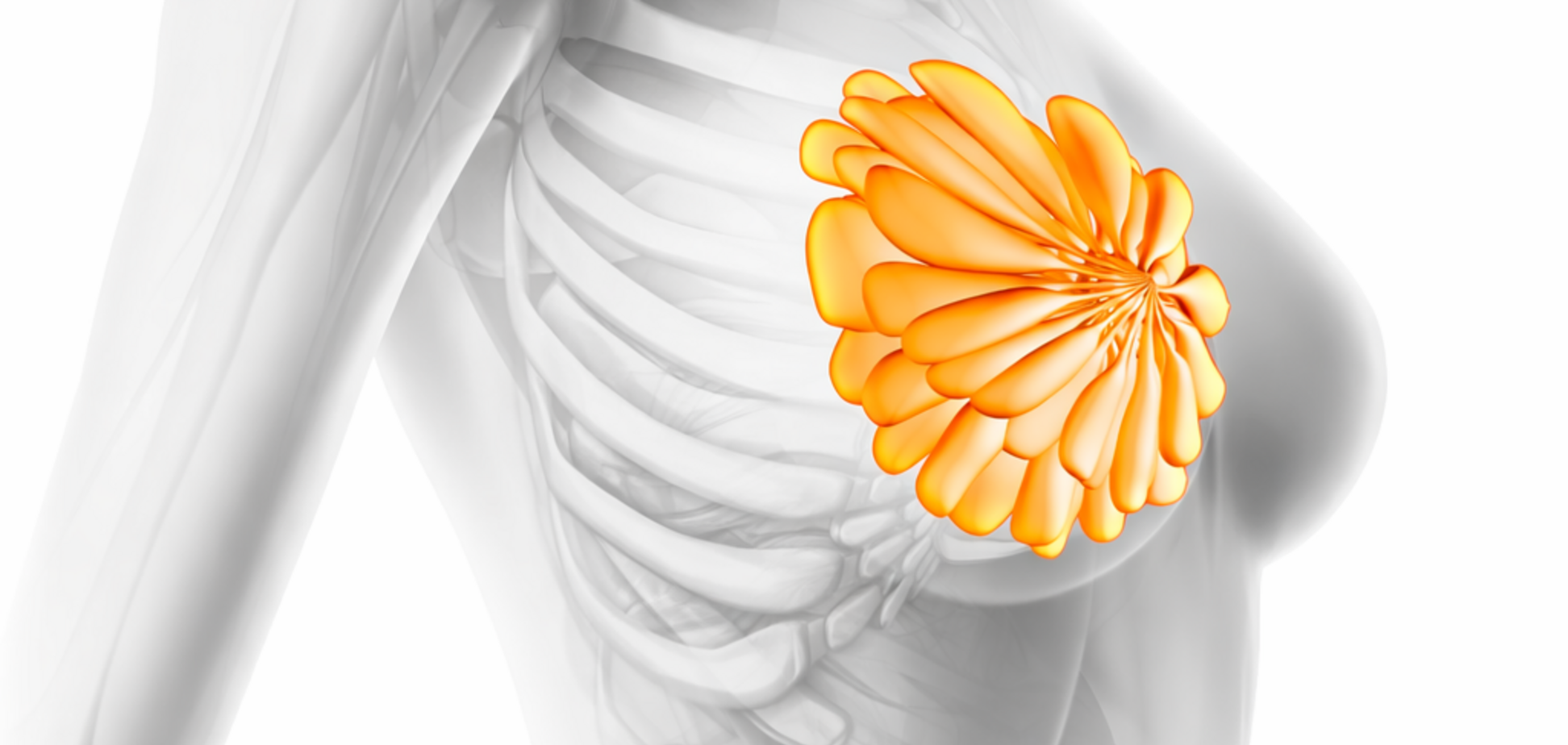 Штучний інтелект і мамографія: менше 'непоміченого' раку у складних випадках