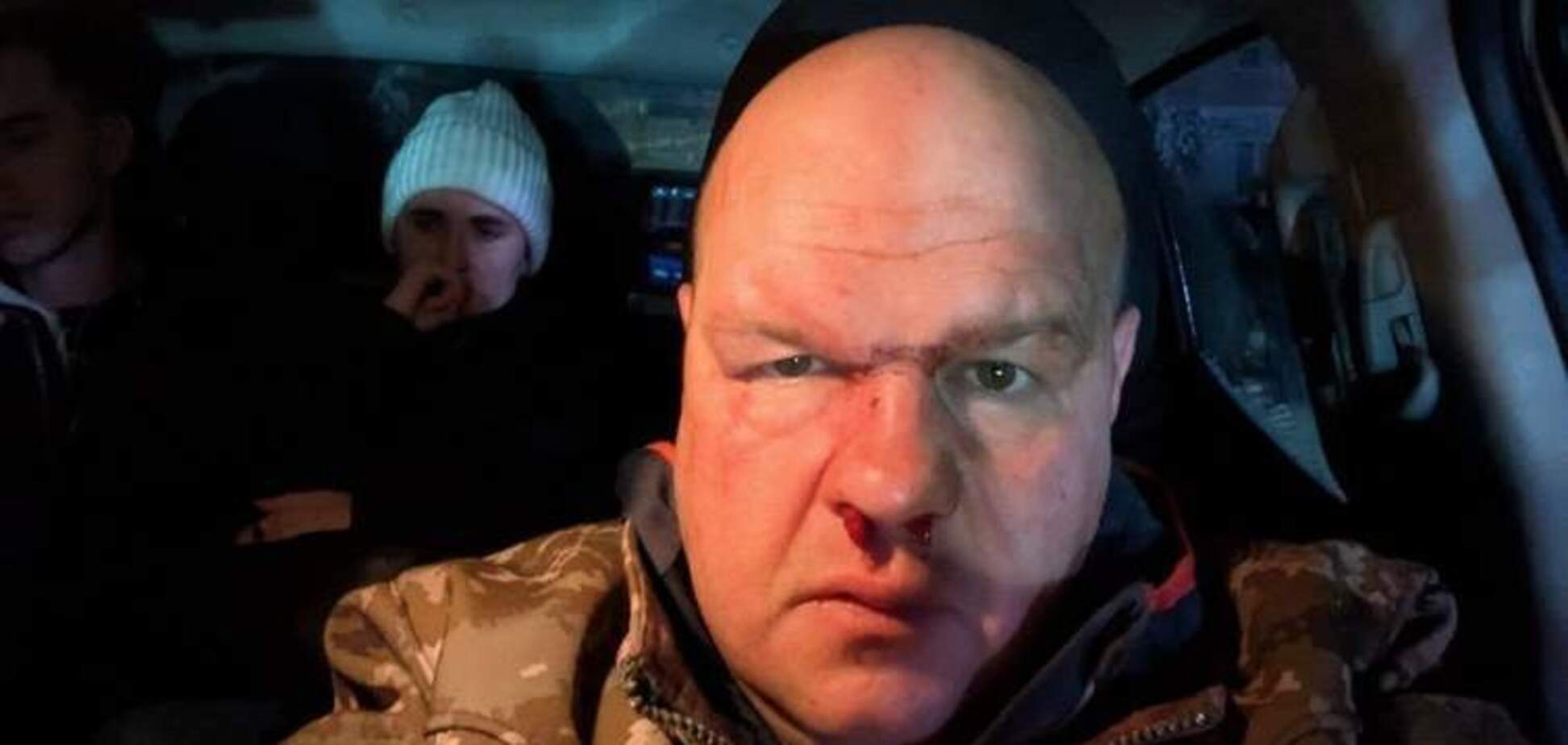 На Тернопільщині мажори після влаштованої ДТП побили військового і намагались зам'яти справу 'за допомогою ТЦК': розгорівся скандал. Відео